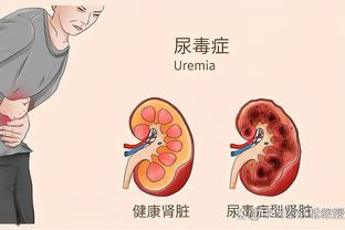 明天勇士VS火箭：小佩顿因伤缺阵 TJD出战成疑